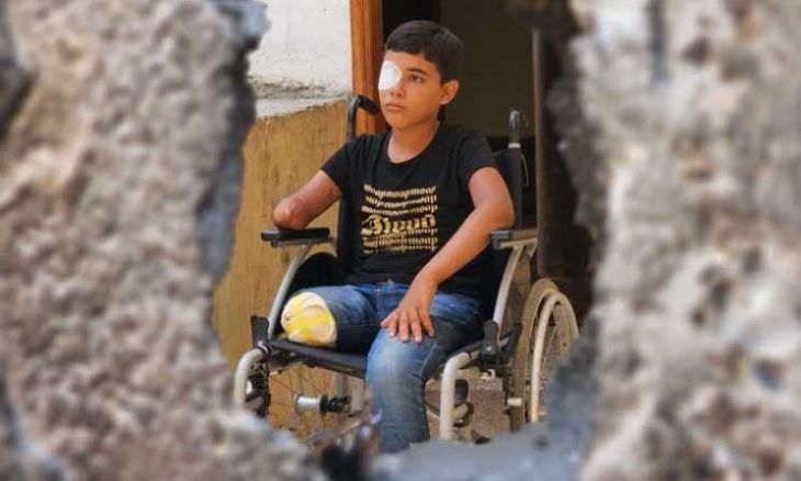 الأمم المتحدة: غزة تضم أكبر عدد من الأطفال مبتوري الأطراف في العالم