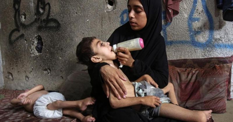 تفشي سوء التغذية الحاد بين أطفال غزة يهدد حياة الآلاف