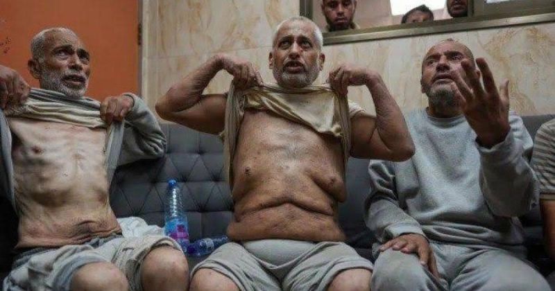 الجرب يجتاح سجون الاحتلال  وتحذيرات من كارثة صحية بين الأسرى