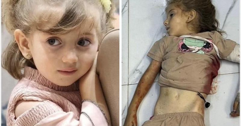 من خيمة النزوح إلى ثلاجة الموتى.. منة أبو لبدة شاهدة جديدة على خروقات الهدنة في غزة!