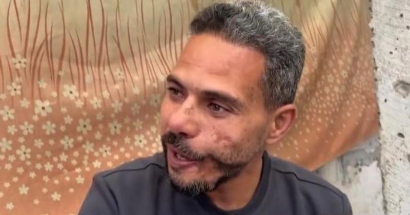 “وجهي احترق لكن الكاميرا نجت”.. المصور محمد القهوجي يحمل آثار الحرب على جسده!