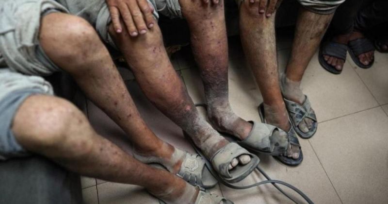 أعين مفقودة وأطراف مبتورة .. هكذا يخرج الأسرى الفلسطينيون من السجون