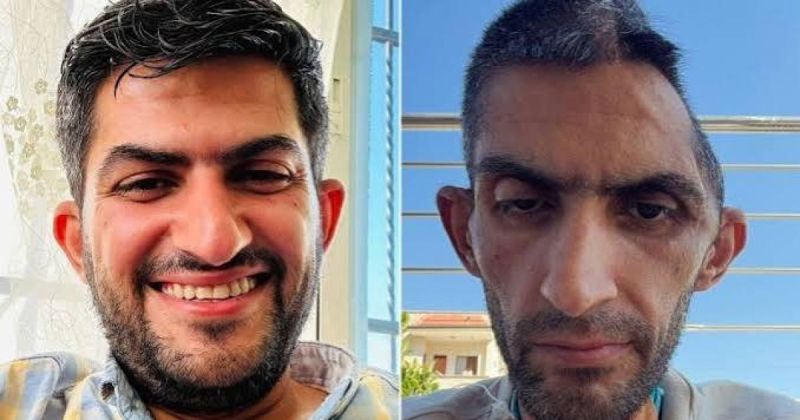 نادي الأسير: معاناة الصحفي مجاهد بني مفلح تكشف آثار "السجن الإبادي" على الأسرى المحررين