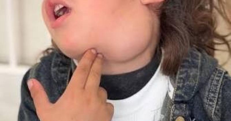 السرطان خطف طفولته والحرب أبعدت والده.. حسنين ينتظر لم شمل أسرته