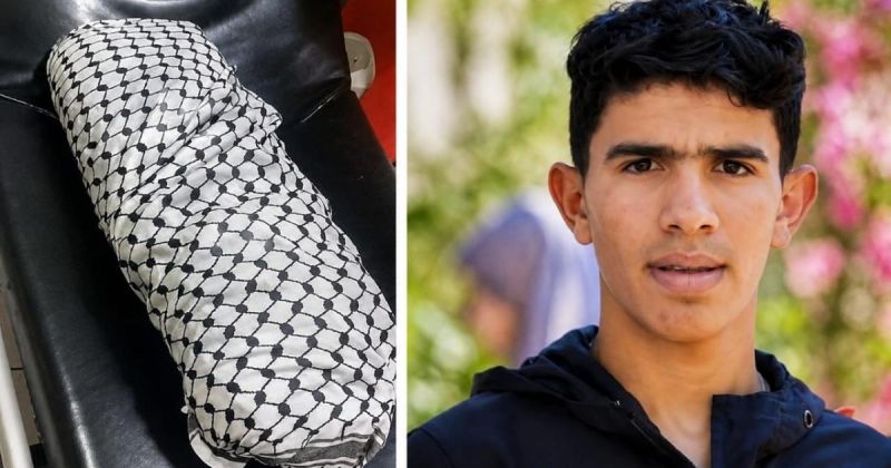 ساق الأسير محمد حميد.. جريمة احتلال تُضاف إلى جسد طفل فلسطيني