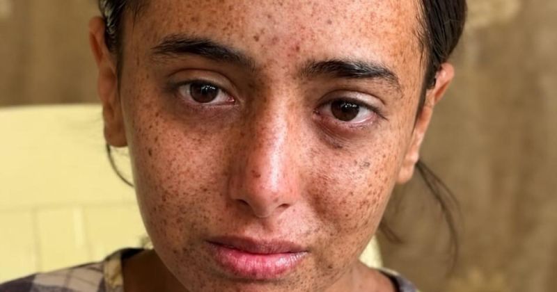 ميس القدرة.. طفلة من غزة  تحاصرها الشمس والحرب معا 
