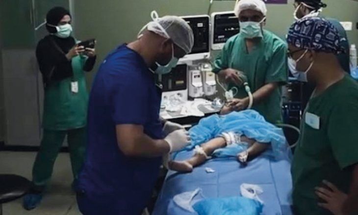 بعد توقف لثلاث سنوات: استئناف عمليات زراعة القوقعة لأطفال غزة