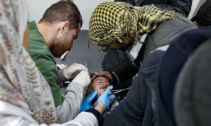 حرب الأسنان في غزة: نقص المستلزمات يجبر المرضى على 'الخلع' بدلاً من العلاج