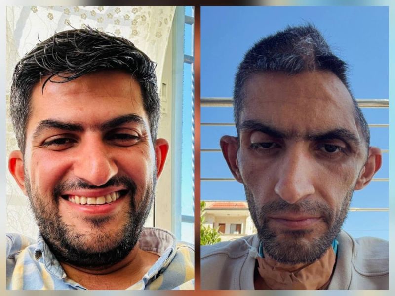 نادي الأسير: صورة الصحفي مجاهد بني مفلح تجسد سياسة الإبادة داخل السجون الإسرائيلية