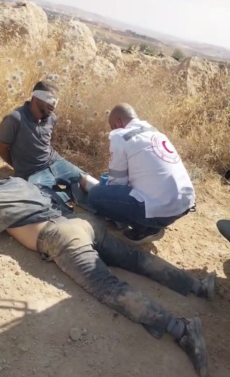 إصابات في اعتداء للمستوطنين جنوب الخليل