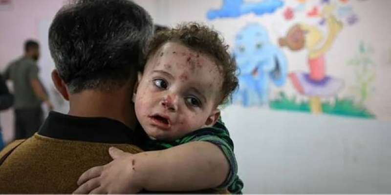 الجدري ينهش أجساد الأطفال في غزة.. مؤشرات مقلقة وأزمة صحية تتفاقم