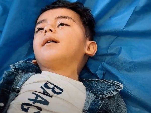 عملية دقيقة تنقذ طفلاً في ظل انهيار صحي بغزة
