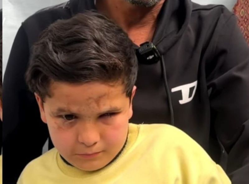 “ظنّها لعبة”.. مخلفات الإبادة في غزة تسلب الطفل محمد بصره