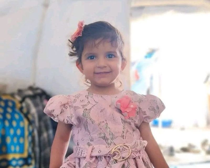 طفلة تلتحق بوالدها وشقيقتها الشهداء متأثرة بإصابتها في قصف غربي غزة