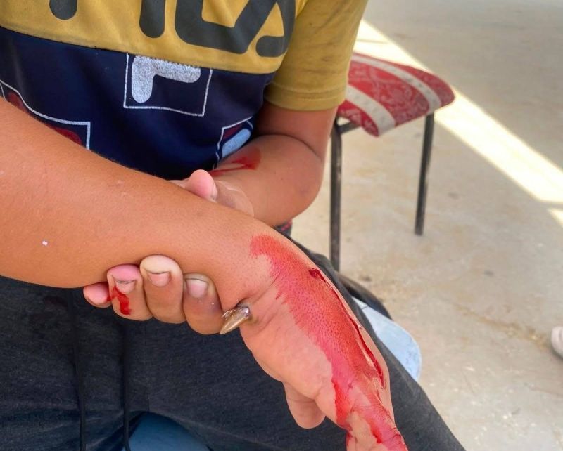 الاحتلال يصيب طالبا فلسطينيا برصاصة داخل مدرسته غرب غزة