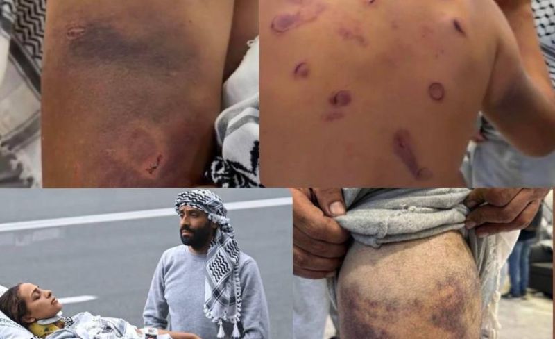 تحقيقات وشهادات متطابقة تؤكد الاعتداءات الجنسية بحق الأسرى