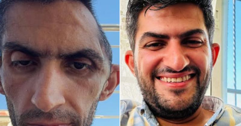 مجاهد بني مفلح.. صورة أسير محرر تكشف كلفة الاعتقال الإداري وسياسات الإهمال الطبي في سجون الاحتلال