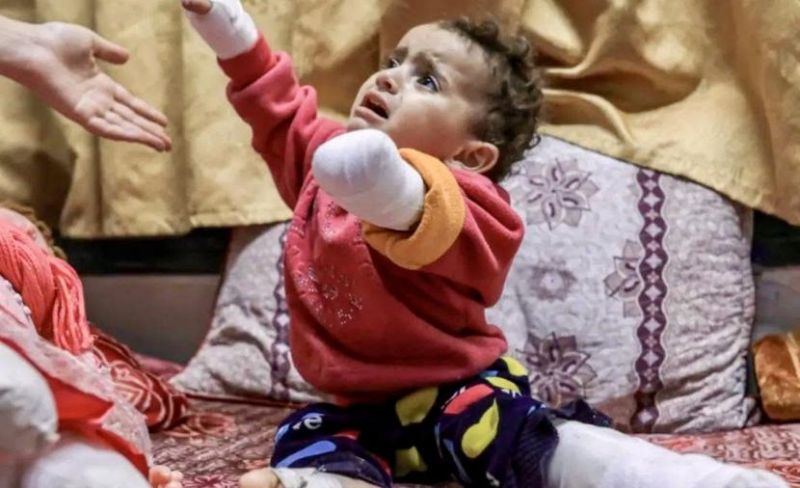 ناجون مع وقف التنفيذ.. مبتورون بغزة بين نخز البلاتين وشلل الوريد الطبي