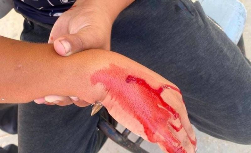 إصابة طالب بنيران جيش الاحتلال غربي مدينة غزة