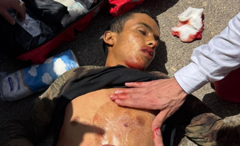 شهيد طفل و4 إصابات برصاص المستوطنين شمال رام الله