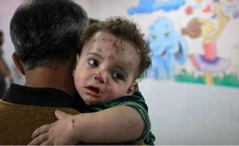 58 ألف إصابة بـ "جدري الماء" بغزة منذ مطلع العام