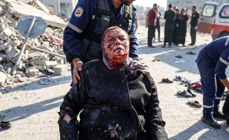 7 شهداء و23 جريحا بقطاع غزة أمس الثلاثاء