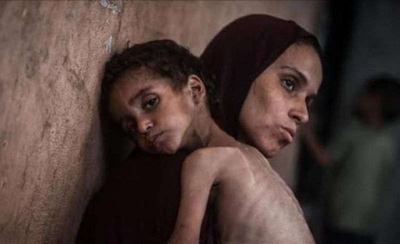 الصحة: 67% من سكان غزة سيواجهون أزمة غذائية حتى نهاية 2026