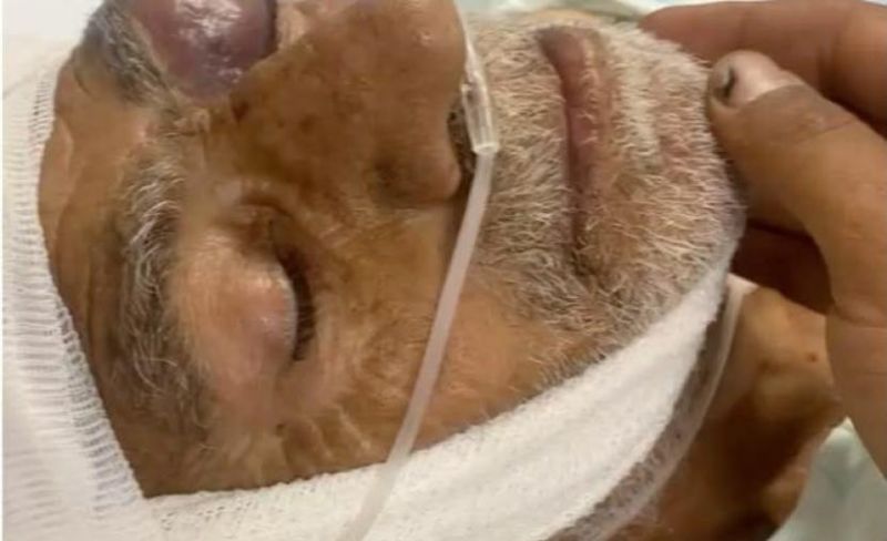 إصابة مسنّ باعتداء للمستوطنين غرب سلفيت