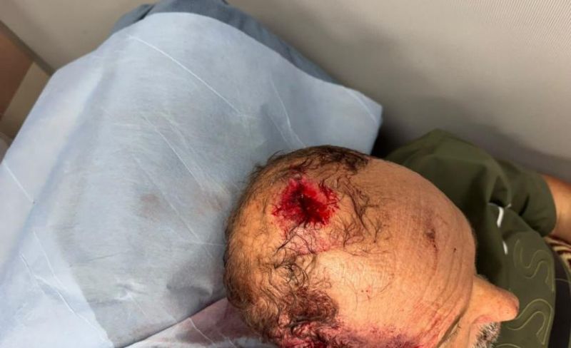 إصابة فلسطيني باعتداء للمستوطنين برام الله